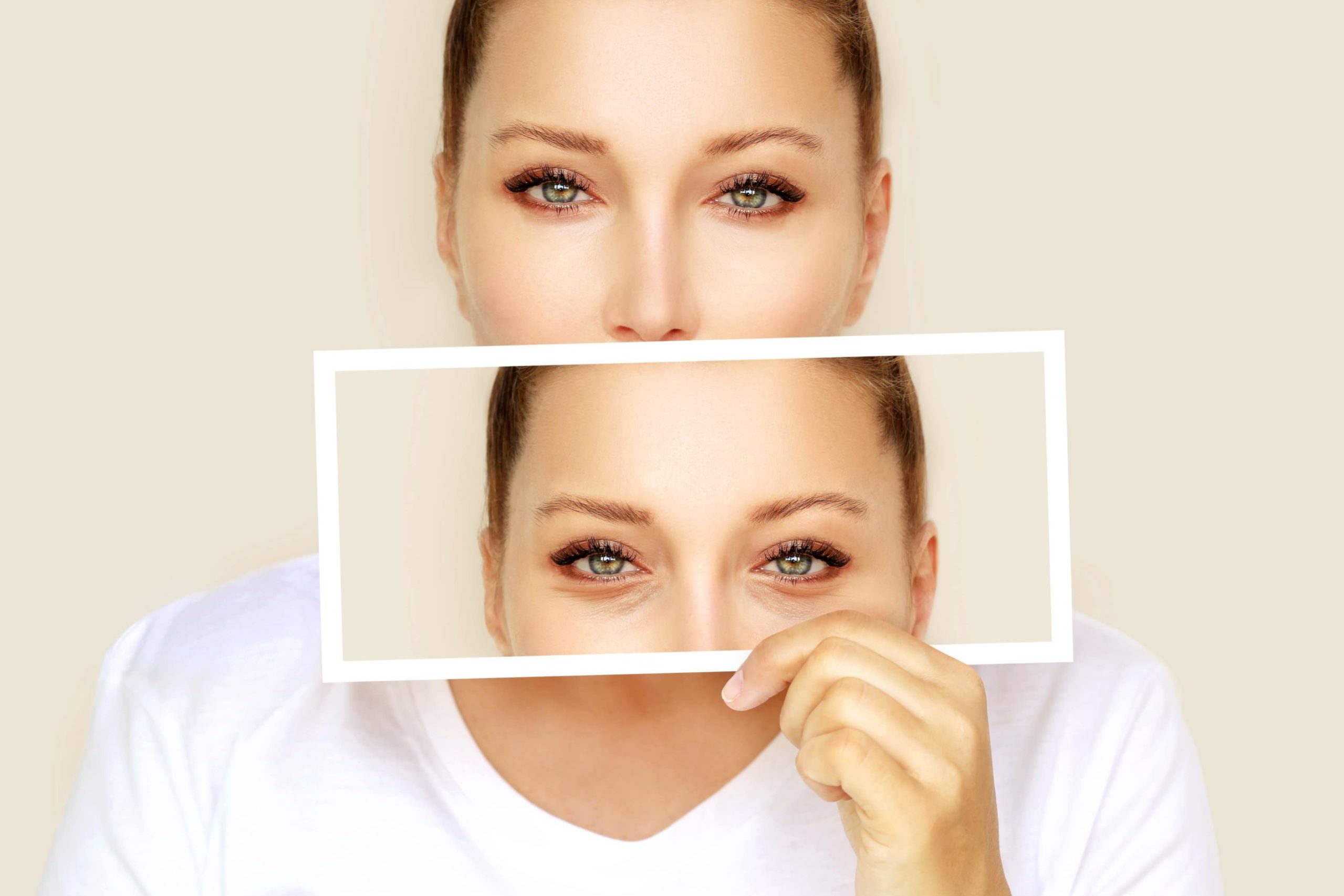 What Is A Blepharoplasty Or Eyelid Surgery