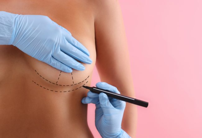 Breast Augmentation by Aesthetic Center of Plastic Surgery in North Dakota
