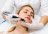 dermaplaning