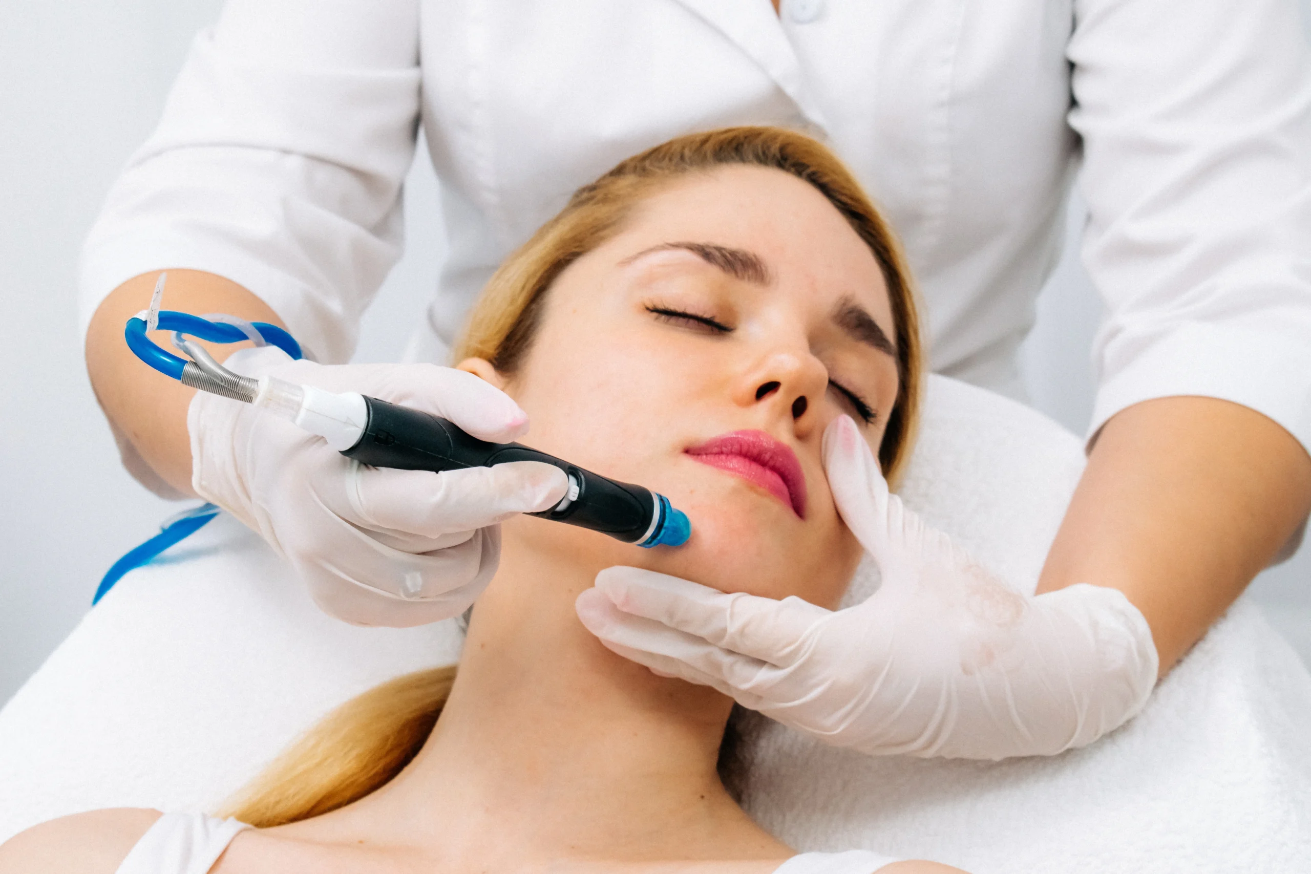 dermaplaning