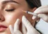 Why Sculptra Is Becoming More Popular in 2025