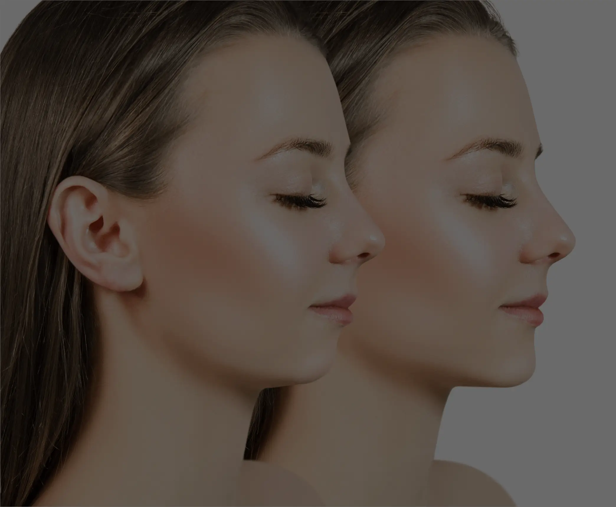 Injectables Treatment in North Dakota