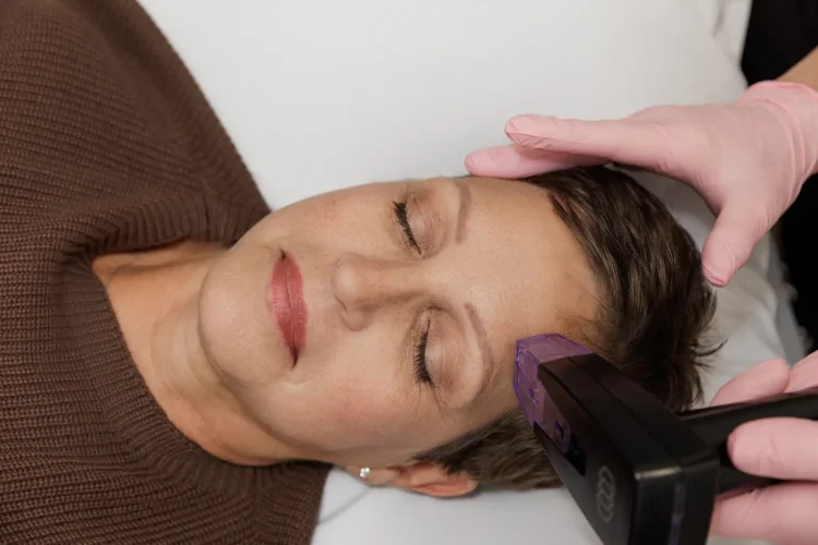 Morpheus8 Treatments the asthetic center in North Dakota