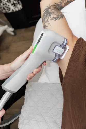 miraDry® Sweat Reduction at the asthetic center in North Dakota