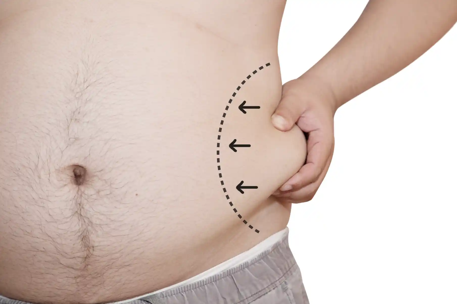 Liposuction services in Bismarck ND